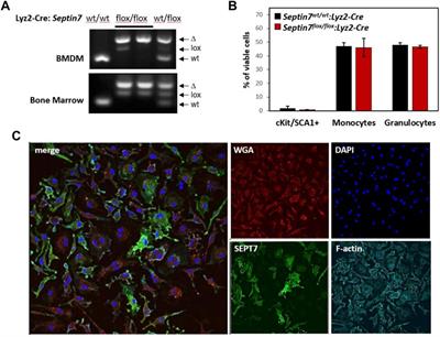 Lyz2-Cre-Mediated Genetic Deletion of Septin7 Reveals a Role of Septins in Macrophage Cytokinesis and Kras-Driven Tumorigenesis